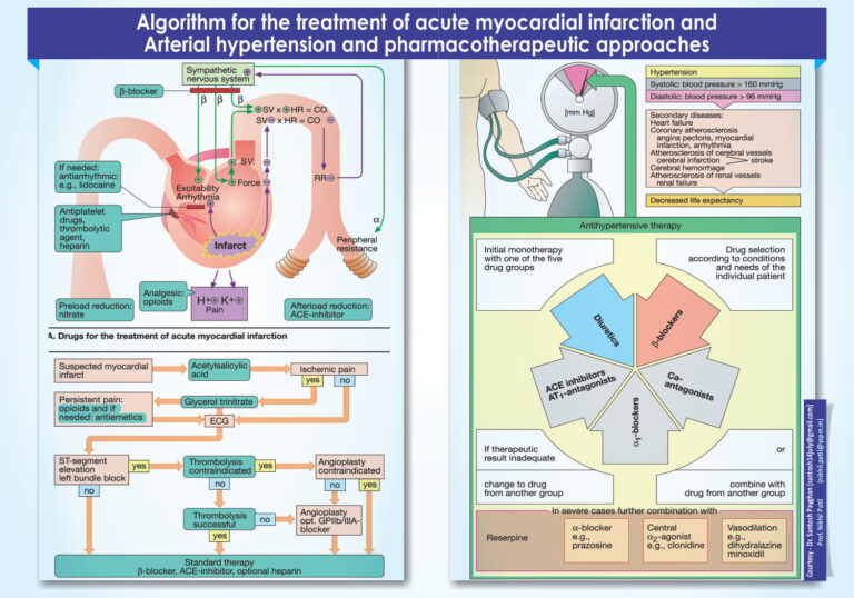 Algorithm for the treatment of acute myocardial infarction and Arterial hypertension and pharmacotherapeutic approaches